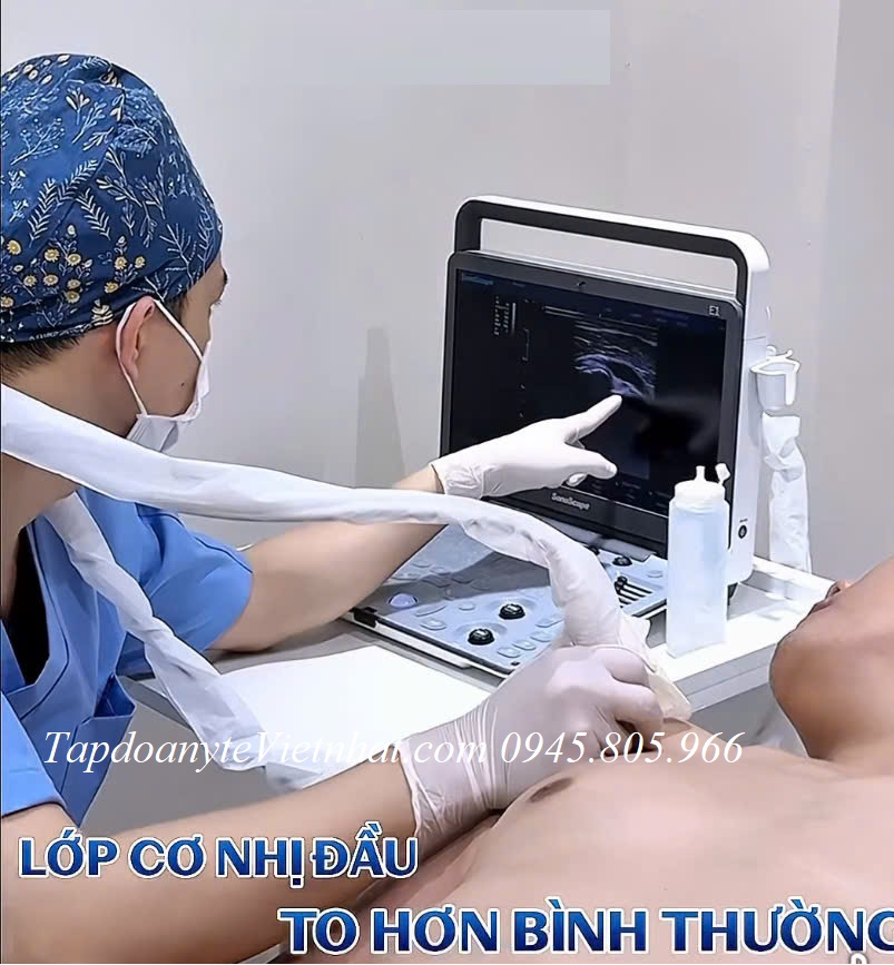 Máy siêu âm cơ xương khớp